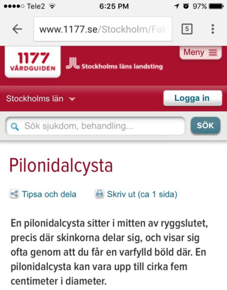 Pilonidalcysta